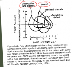 This is a Flow-Volume Loop

The obstructed patient will have:

1. increased overall lung volume
2. decreased inspiratory/expiratory flow