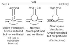 Low V/Q: 
- Shunt perfusion
- Alveoli perfused but not ventilated
- Eg, ET tube in mainstem bronchus

High V/Q:
- Deadspace ventilation
- Alveoli ventilated but not perfused
- Eg, Cardiac arrest