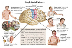 - Abnormal neural firing restricted to a focal brain area

- Usually last for several seconds to a few minutes

- During seizure, patient is alert and maintains awareness and memory for the entire event

- Clinical signs of a seizure (motor,...