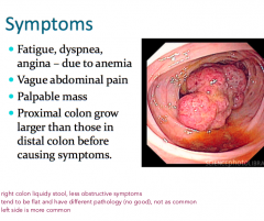 Symptom Prevalence by location:
-																						  Ascending colon (25%) - Transverse colon (15% ) 
-Descending (5% ) 
- Sigmoid colon (35%)
- Rectum (20%) 


 Right Colon – Anemia  Left Colon – Rectal Bleeding                      