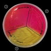What is the purpose of Columbia CNA with 5% sheep’s blood agar?