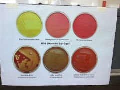 What is the purpose of the high salt concentration in the mannitol salt agar media?
