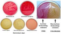 MacConkey agar is selective, differential, or both?