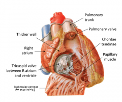A= Tricuspid Valve
B= Papillary muscle
C= Chordae tendinae
D=  Pulmonary valve