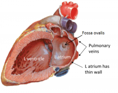 Fossa ovalisPumps blood into the right ventricle