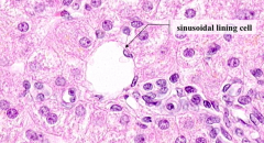 Sinusoidal Lining Cells (basophilic nuclei)