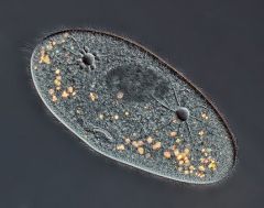 Phylum, genus
Label contactile vacuole, macronucleus and cytostome
Feeding?