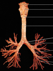 The primary bronchi emerge from the inferior trachea and split into RIGHT and LEFT main bronchus. They then also divide into SECONDARY (lobar) BRONCHI, which each supply one lobe: 3 on the right and 2 on the left. From there, the lobar bronchi br...