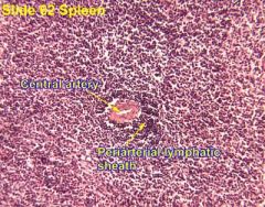 Periarteriolar lymphoid sheaths (PALS)