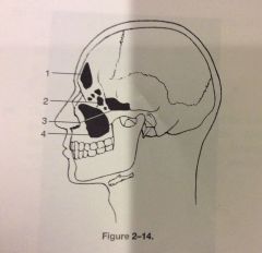 The structure labeled 3 in fig 2-14 is the
A. Maxillary sinus
B. Sphenoidal sinus
C. Ethmoidal sinus
D. Frontal sinus