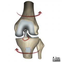 The anterior cruciate ligament (ACL)