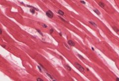 Striated, non-voluntary
Cardiac myoctes are short, wide, and branching.  Cardiac myocytes usually have a single, large nucleus located among the myofibrils.  The intercalated disk of cardiac muscle tissue appear as black lines oriented parallel ...