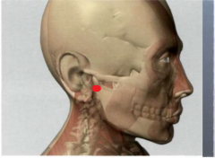 2VB

con la boca abierta, delante de la incisura intertragica,

en la depresión dorsal del cóndilo mandibular