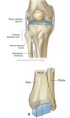 Superior = plane synovial joint
Inferior = (fibrous) syndesmosis joint

Both have very strong ligamentous support