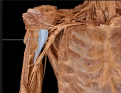 What are the origins and insertions of the highlighted muscle?