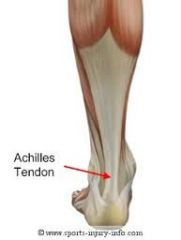 Tendon that attaches the superficial, posterior leg muscles (gastrocnemius, soleus & plantaris) to the calcaneus in the foot=> prone to tendinitis