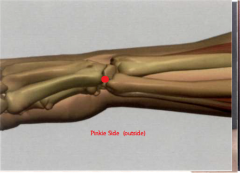 5 ID


en la depresión distal del proceso estiloides del cubito, a

la altura del extremo cubital del pliegue distal de flexión

de la articulación de la muñeca


 


 


 