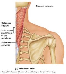 Origin: Nuchal ligament and spinous process T1-T6
Insertion: tubercles of transverse processes of C1-C4

Action: bilaterally will extend the head and neck and unilaterally will laterally flex neck and rotate head to side of contraction

BS: M...