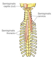 Cervicis: Cervical transverse processes to spinous processes of 2nd cervical vertebra
BS: Deep cervical artery

Capitis:superficial to cervicis
Comes from transverse processes of T1-T6 vertebra inserting into the nuchal line
BS: deep cervical...