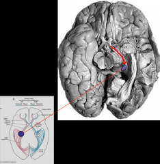 -around the brainstem near the crus cerebri 
-contact the lateral geniculate nucleus of the thalamus