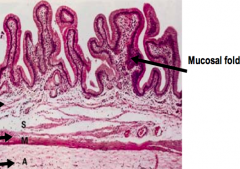 - Mucosa made of simple columnar epithelial cells
- Resembles the absorptive cells of the intestine
- Cells have numerous short apical microvilli 
- Basally located nucleus