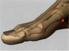 2R


en la parte interna del pie, por debajo de la tuberosidad

del hueso navicular, en el límite entre la carne roja y la

blanca