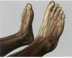 41E

en la depresión del centro del pliegue transversal

anterior de la articulación superior del tobillo, entre

los tendones del m. extensor largo del dedo gordo

y el m. extensor largo de los dedos