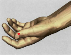  


11P


0,1 Tsun proximal y lateralmente hacia el ángulo radial

de la uña del dedo pulgar


 