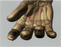 8MC

en la palma de la mano, entre el 2° y el 3o metacarpiano,

donde entra en contacto con el extremo del dedo

corazón al cerrar el puño


 