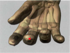 9MC


en el centro del extremo del dedo corazón