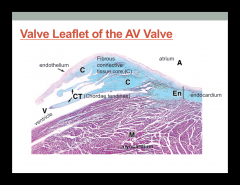 Located between right atrium and ventricle 


 


3 cusps 


 


Free edge of each cusp is anchored to the papillary muscles in the floor of the right ventricle by chordae tendinae 


 


Fibrous connective tissue core 