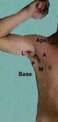 Apex-all the way at the top
Base (a and p folds)
anterior wall
posterior wall
medial wall 
lateral wall