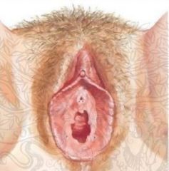 En la imagen identifique: Monte de Venus, Prepucio del clítoris, labio mayor, vestíbulo, introito vaginal, labio menor, glande del clítoris, clítoris