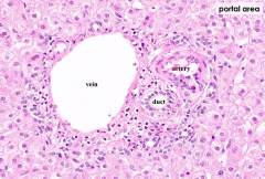 - Common Bile Duct
- Hepatic Portal Vein
- Proper Hepatic Artery