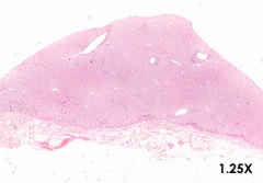 What do you notice about the tissue of the liver?