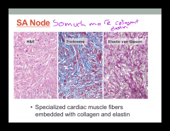collagen and elastin SA node 