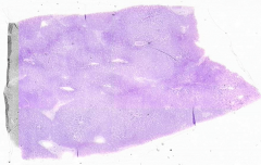 What do you notice about the 1 µm tissue section of the liver?
