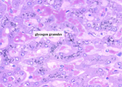 Hepatocytes containing black material - these are glycogen granules