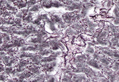 Silver-stained reticular fiber, composed of type III fibrillar collagen