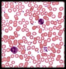 Identify the formed elements in this blood smear: