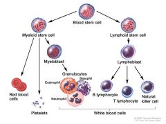 1. Acute Myelogenous Leukemia (AML)
2. Acute lymphocytic Leukemia (ALL)
- acute leukemias account for 60% of all leukemias, 25% are CLL and 15% are CML