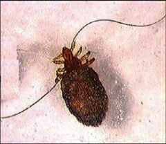 Dog sucking louse (Anoplura)