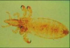 Long Nose Cattle Louse (Anoplura)