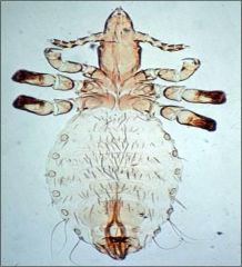Sucking Lice (Anoplura)