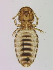 Bitting Lice (Mallophaga)