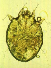 Scabies Mite (Sarcoptidae)