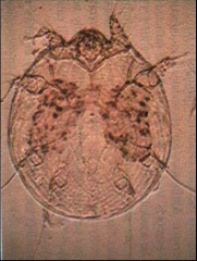 Mange Mite (Sarcoptidae)