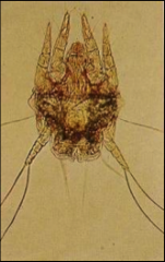 Ear Mite of Dogs and Cats (Psoroptidae)