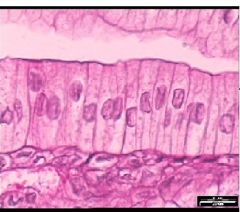 These epithelial cells are likely to be found doing what?