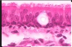 This cell is likely to be found in the nasal passages, trachea, & bronchi. It is _____ tissue and specifically called ______. The little hairs that move material along are called _____